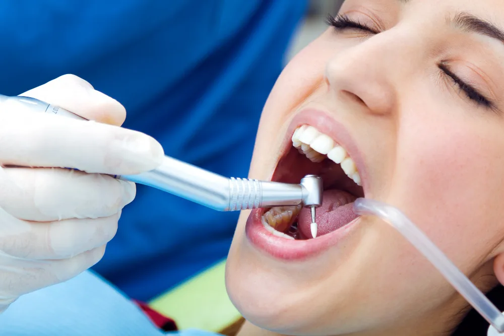 Limpieza dental